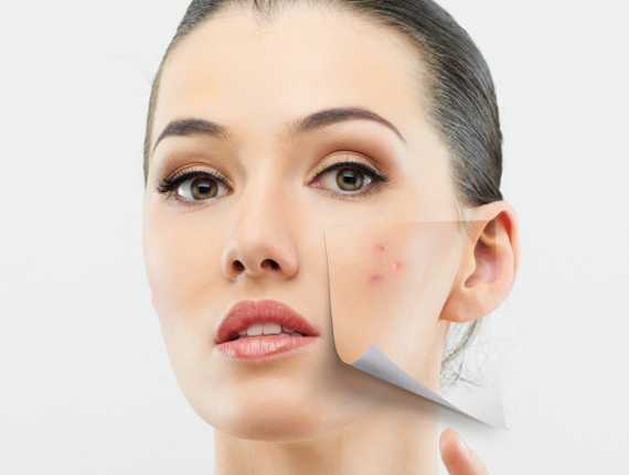 Vitamin E Treats Skin Hyperpigmentation
